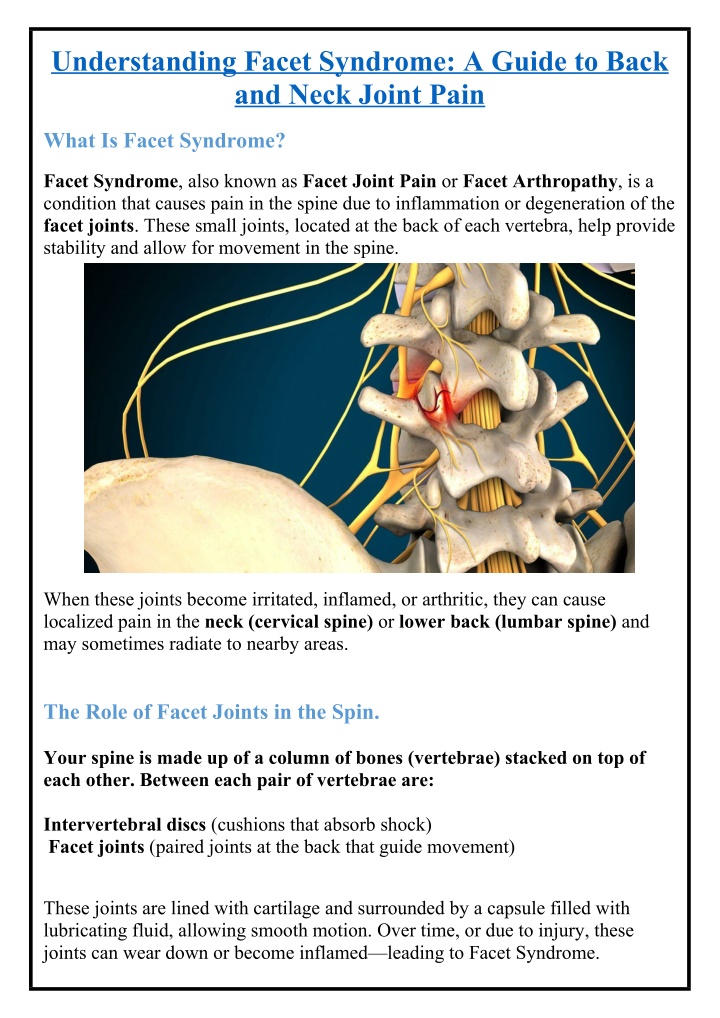understanding facet syndrome a guide to back n.w