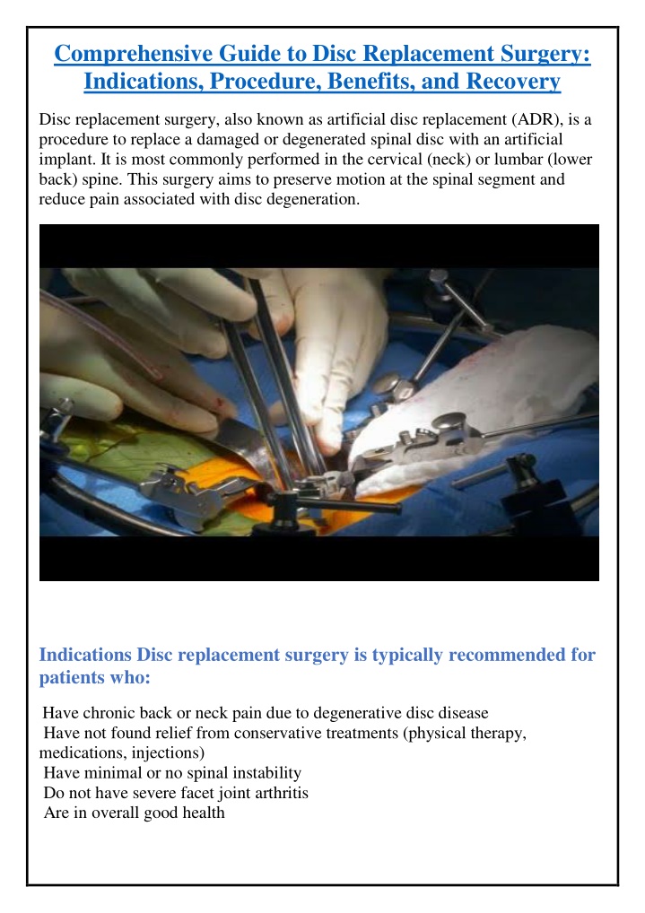 comprehensive guide to disc replacement surgery n.w