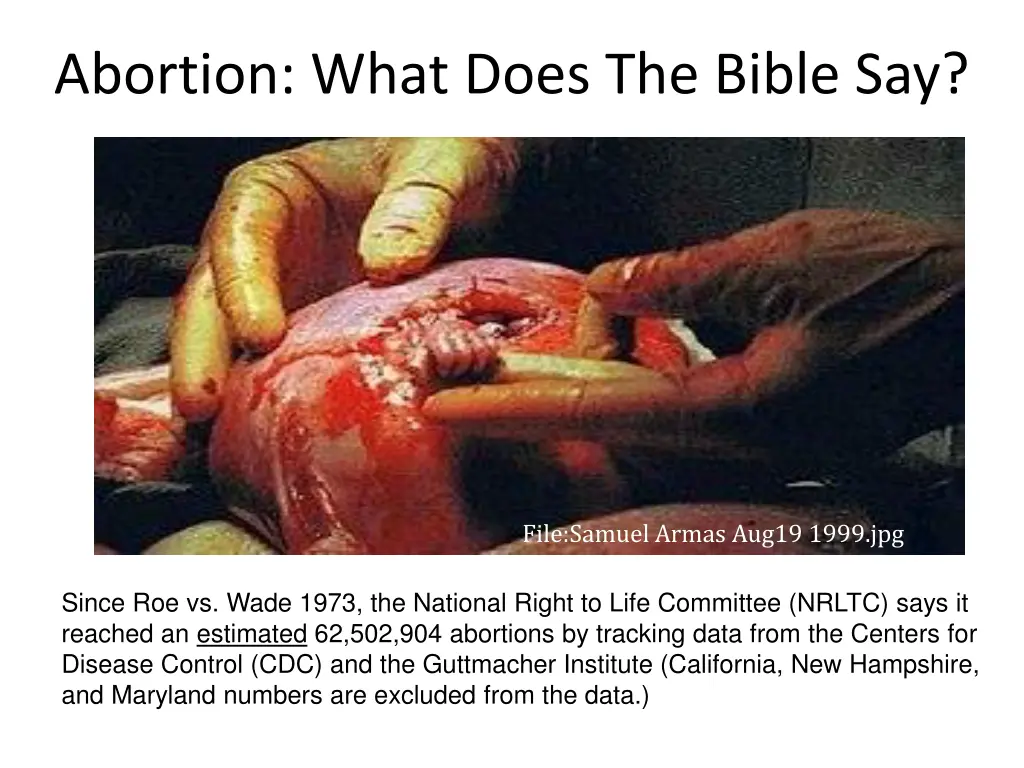 abortion what does the bible say n.w