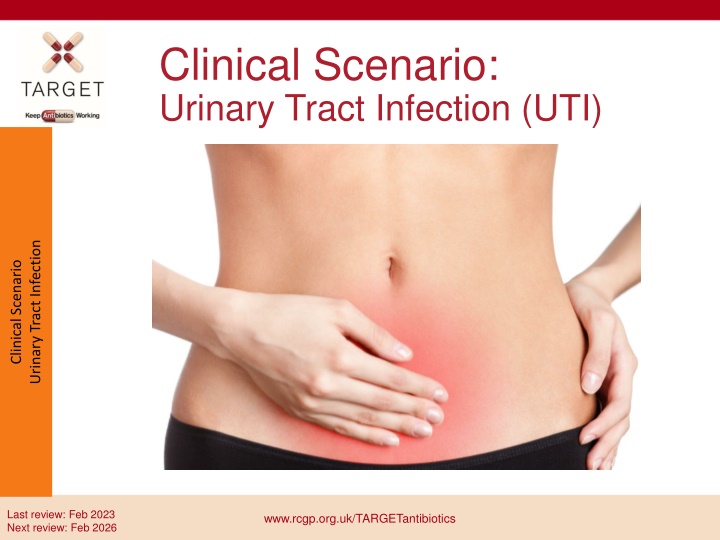 Antibiotic Use in UTI Management: A Critical Review