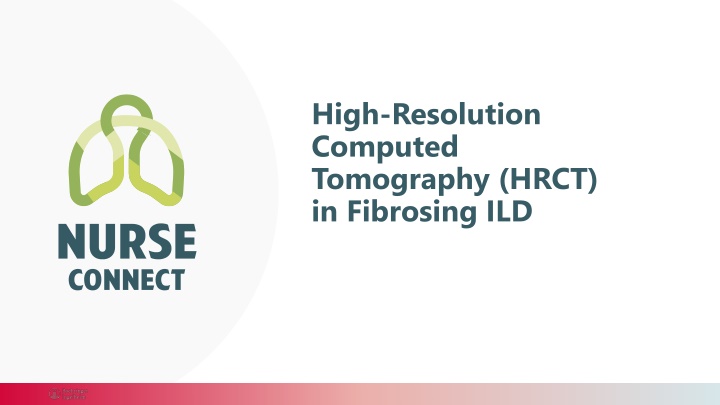 Role of High-Resolution Computed Tomography in Fibrosing Interstitial Lung Diseases