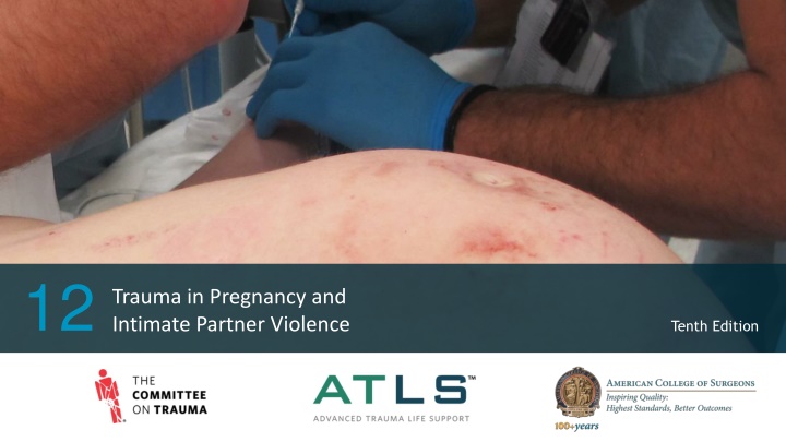 Trauma in Pregnancy and Intimate Partner Violence - 10th Edition