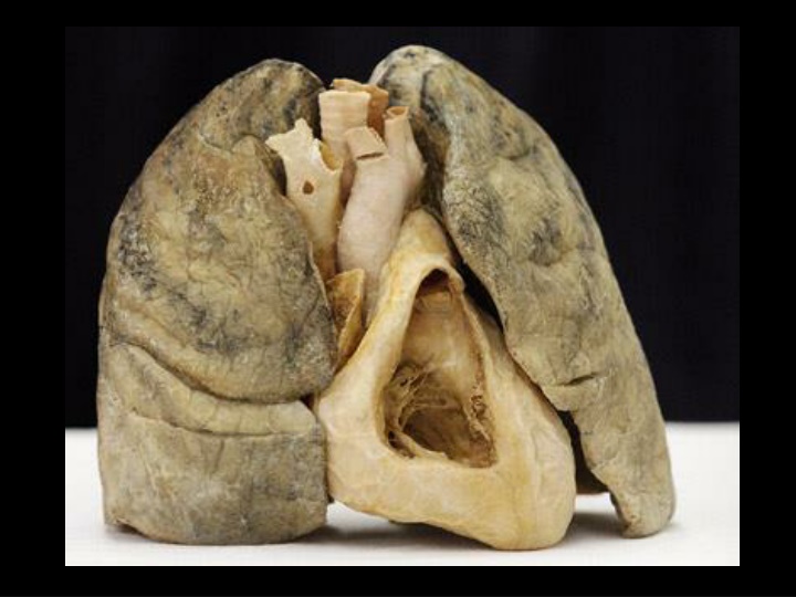 Functions of the Respiratory System and Ventilation Mechanism