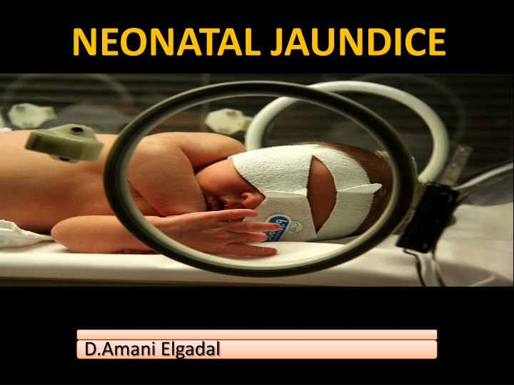 NEONATAL JAUNDICE