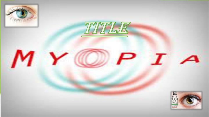 Myopia - A Comprehensive Overview