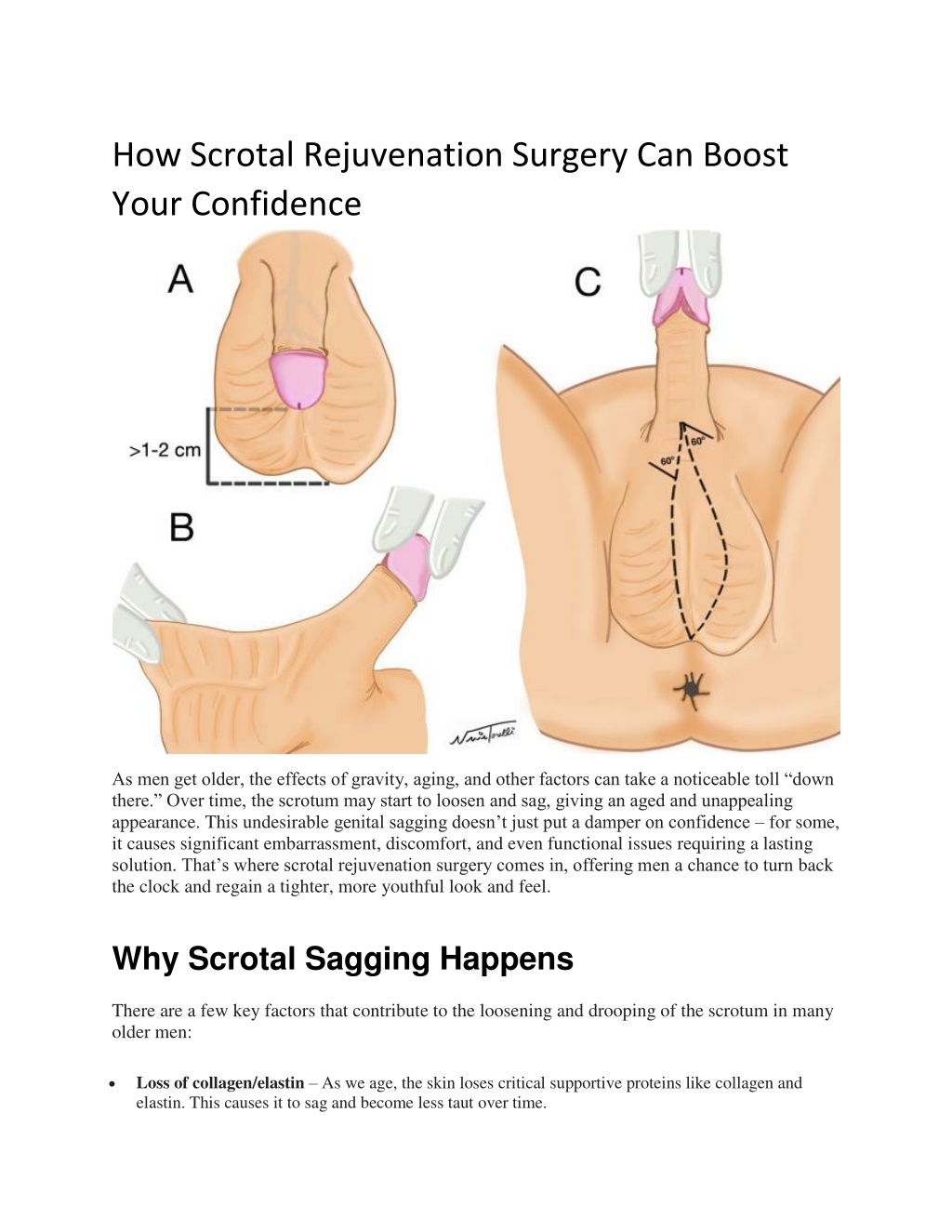 how scrotal rejuvenation surgery can boost your l.w