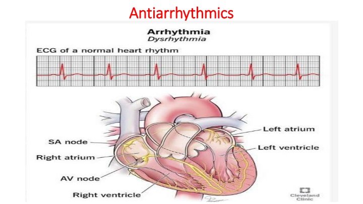 Antiarrhythmics