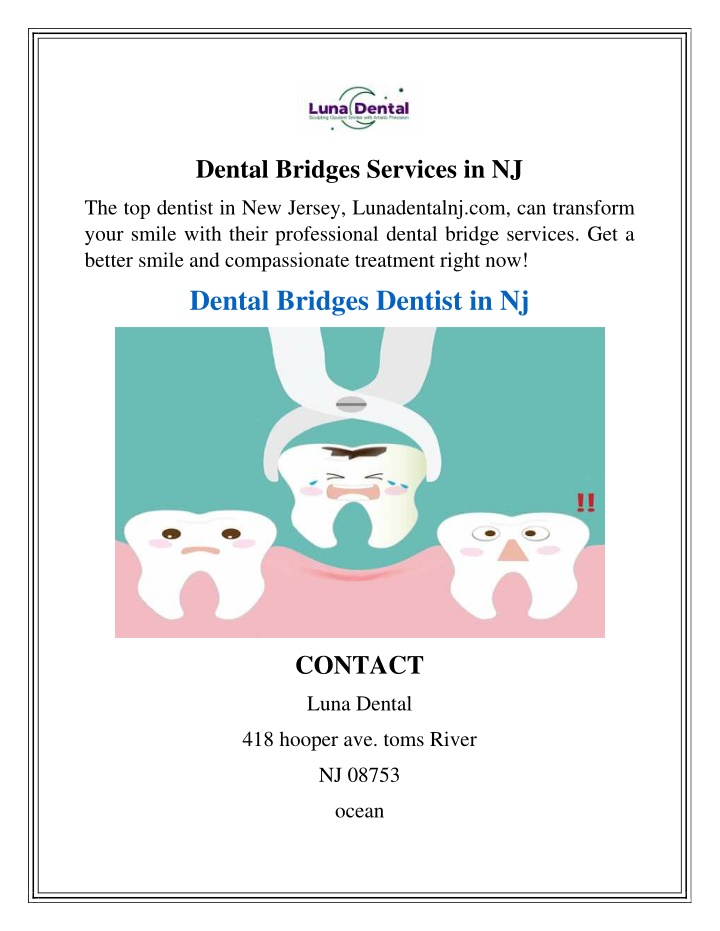 dental bridges services in nj n.w