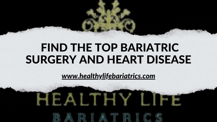 find the top bariatric surgery and heart disease n.w